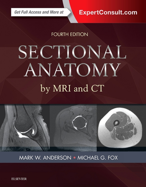 Sectional Anatomy by MRI and CT -  Mark W. Anderson,  Michael G Fox