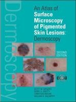 An Atlas of Surface Microscopy of Pigmented Skin Lesions: Dermoscopy,  Second Edition - Scott Menzies, Kerry Crotty, Christian Ingwar, William H. McCarthy