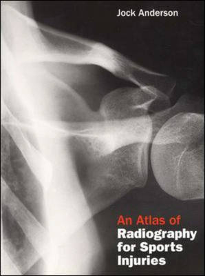 An Atlas of Radiography for Sports Injuries - Jock Anderson