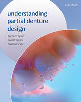 Understanding Partial Denture Design - Kenneth Tyson, Robert Yemm, Brendan Scott
