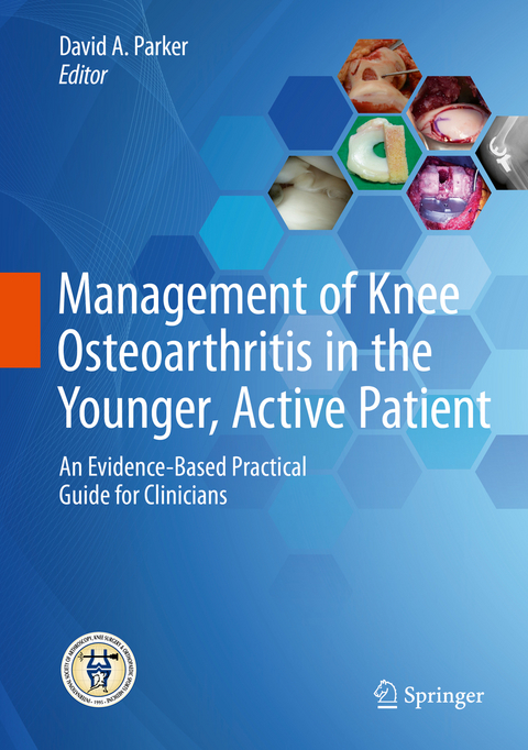 Management of Knee Osteoarthritis in the Younger, Active Patient - 
