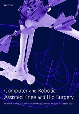 Computer and Robotic Assisted Hip and Knee Surgery - 