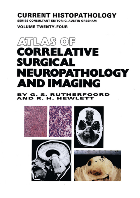 Atlas of Correlative Surgical Neuropathology and Imaging - G.S. Rutherfoord, R.H. Hewlett