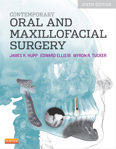 Contemporary Oral and Maxillofacial Surgery - E-Book -  James R. Hupp,  Myron R. Tucker,  Edward Ellis