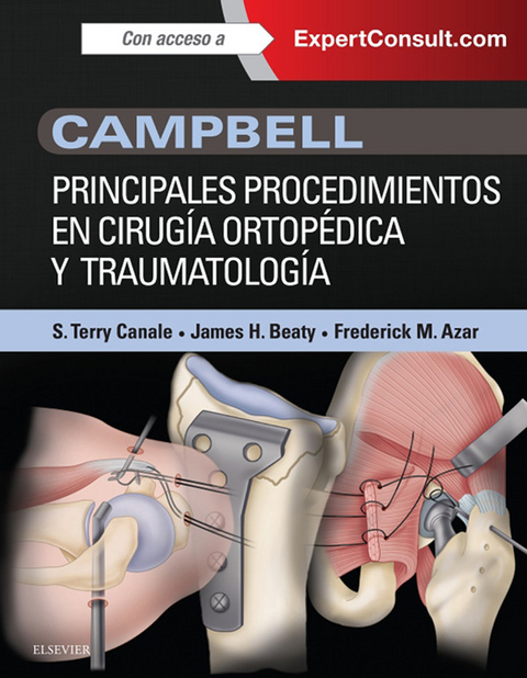 Campbell. Principales procedimientos en cirugía ortopédica y traumatología - 