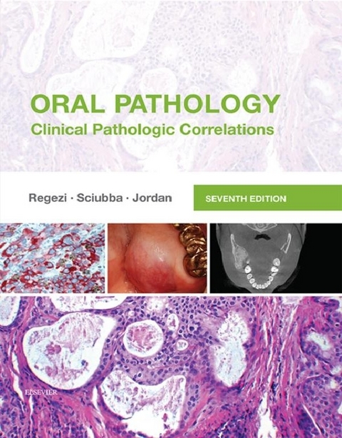 Oral Pathology - E-Book -  Richard C. K. Jordan,  Joseph A. Regezi,  James Sciubba