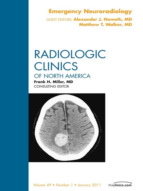 Emergency Neuroradiology, An Issue of Radiologic Clinics of North America -  Alexander Nemeth,  Matthew T. Walker