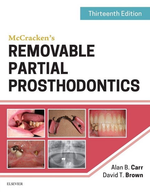 McCracken's Removable Partial Prosthodontics -  David T. Brown,  Alan B. Carr