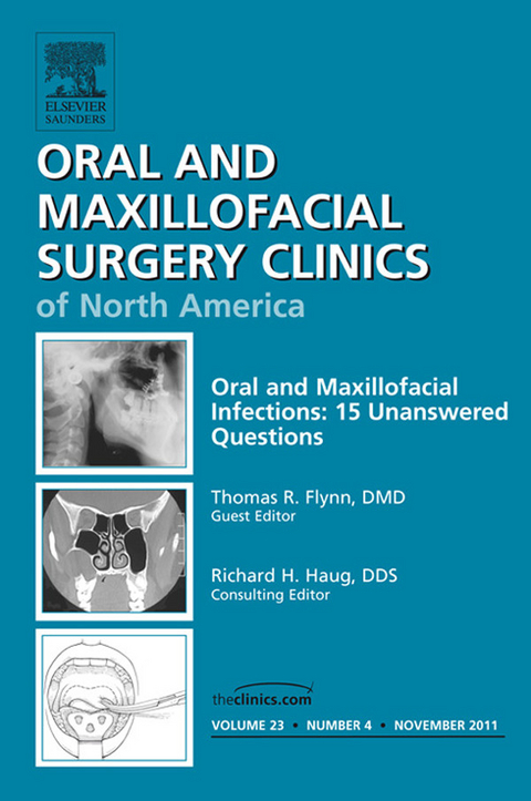 Unanswered Questions in Oral and Maxillofacial Infections, An Issue of Oral and Maxillofacial Surgery Clinics -  Thomas R. Flynn
