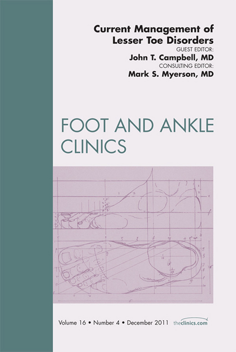 Current Management of Lesser Toe Deformities, An Issue of Foot and Ankle Clinics -  John H. Campbell,  Mark S. Myerson