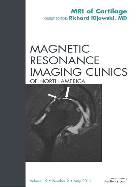 Cartilage Imaging, An Issue of Magnetic Resonance Imaging Clinics -  Richard Kijowski