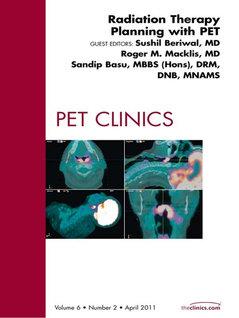 Radiation Therapy Planning, An Issue of PET Clinics -  Sushil Beriwal