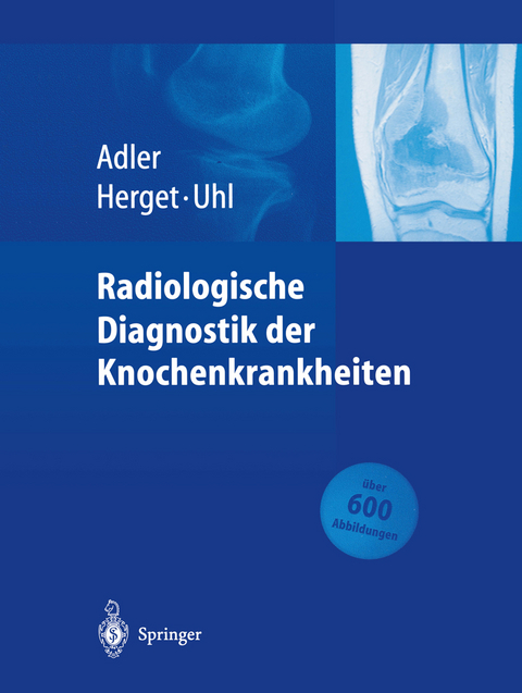 Radiologische Diagnostik der Knochenkrankheiten - Claus-Peter Adler, Georg Herget, Markus Uhl