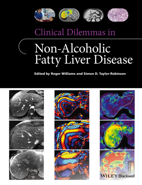 Clinical Dilemmas in Non-Alcoholic Fatty Liver Disease -  Simon D. Taylor-Robinson,  Roger Williams