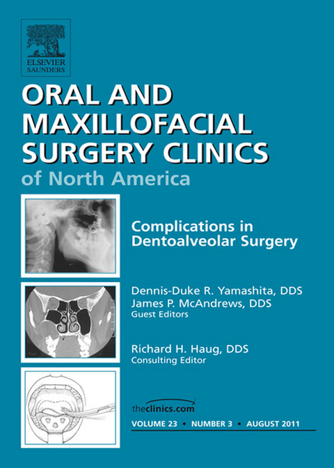 Dento-Alveolar Complications, An Issue of Oral and Maxillofacial Surgery Clinics -  James P. McAndrews,  Dennis-Duke R. Yamashita