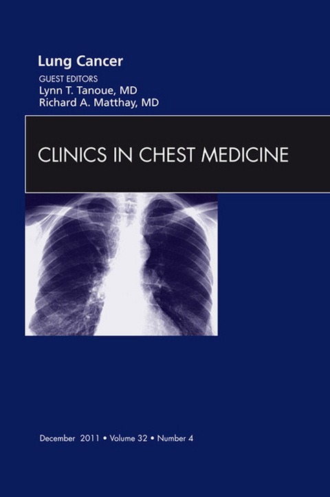 Lung Cancer, An Issue of Clinics in Chest Medicine -  Richard A. Matthay,  Lynn T. Tanoue