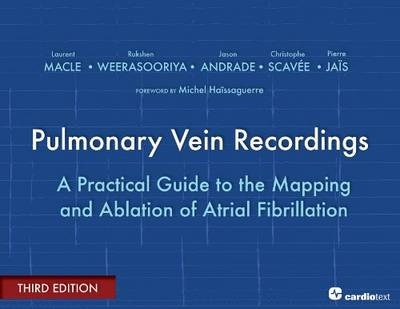 Pulmonary Vein Recordings - Laurent Macle, Rukshen Weerasooriya, Jason Andrade