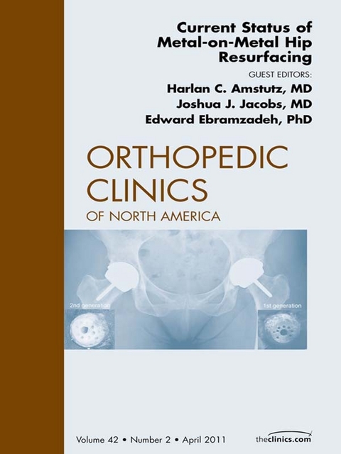 Current Status of Metal-on-Metal Hip Resurfacing, An Issue of Orthopedic Clinics -  Harlan Amstutz,  Eddie Ebramzadeh,  Joshua Jacobs