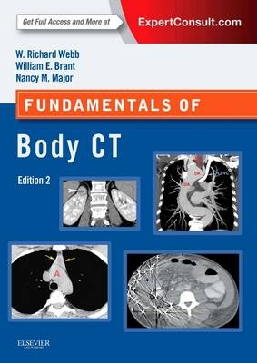 Fundamentals of Body CT - W. Richard Webb, Wiliam E. Brant, Nancy M. Major