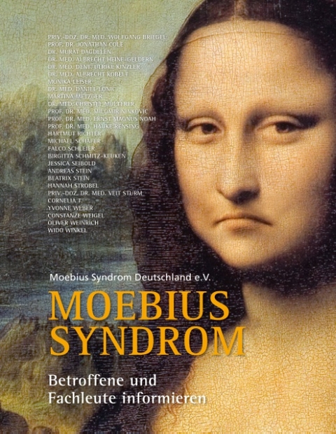 Moebius Syndrom - 