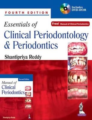 Essentials of Clinical Periodontology and Periodontics - Shantipriya Reddy