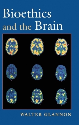 Bioethics and the Brain - Walter Glannon