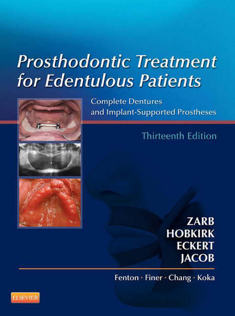 Prosthodontic Treatment for Edentulous Patients -  Steven Eckert,  John Hobkirk,  Rhonda Jacob,  George A. Zarb