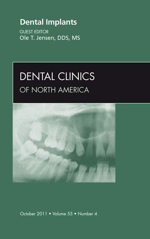 Dental Implants, An Issue of Dental Clinics -  Ole Jensen
