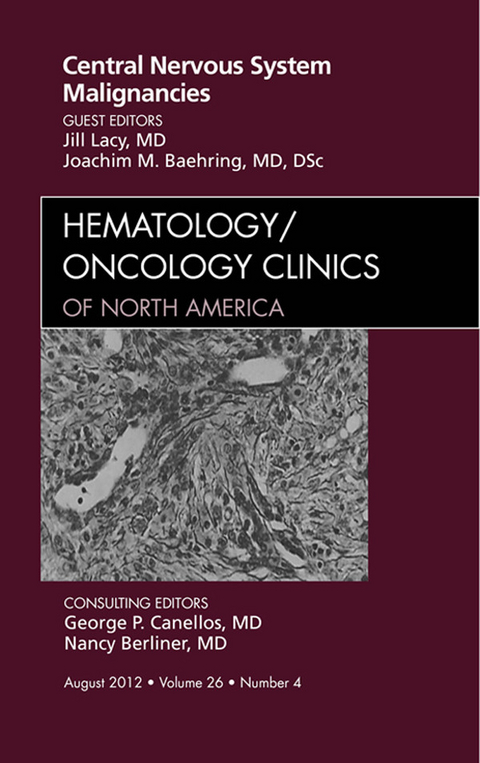 Central Nervous System Malignancies, An Issue of Hematology/Oncology Clinics of North America -  Joachim M. Baehring,  Jill Lacy