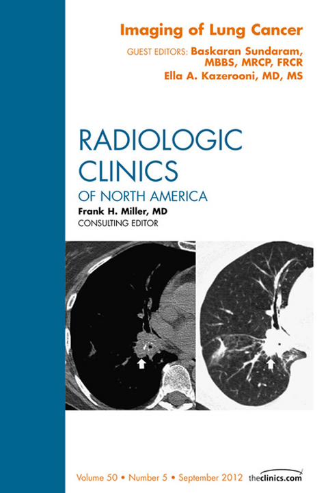 Imaging of Lung Cancer, An Issue of Radiologic Clinics of North America -  Ella A. Kazerooni,  Baskaran Sundaram
