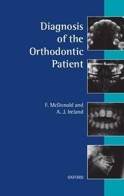 Diagnosis of the Orthodontic Patient - F. McDonald, A. J. Ireland