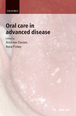 Oral Care in Advanced Disease - 