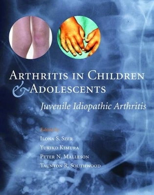 Arthritis in Children and Adolescents - 