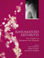 Rheumatoid Arthritis - 