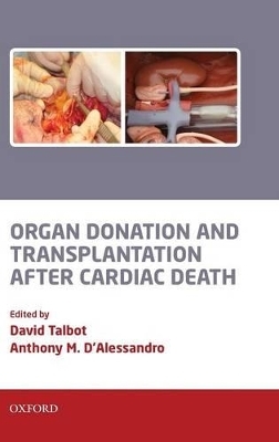 Organ Donation and Transplantation after Cardiac Death - 