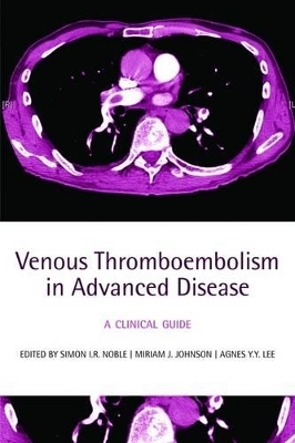 Venous Thromboembolism in Advanced Disease - 