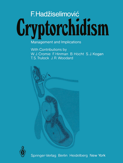 Cryptorchidism - F. Hadziselimovic