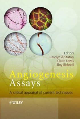 Angiogenesis Assays - CA Staton