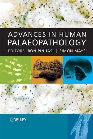 Advances in Human Palaeopathology - 