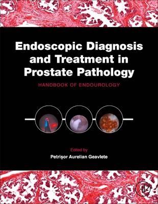 Endoscopic Diagnosis and Treatment in Prostate Pathology - 