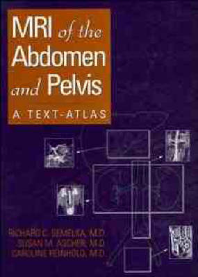 MRI of the Abdomen and Pelvis - Richard C. Semelka,  etc., Caroline Reinhold