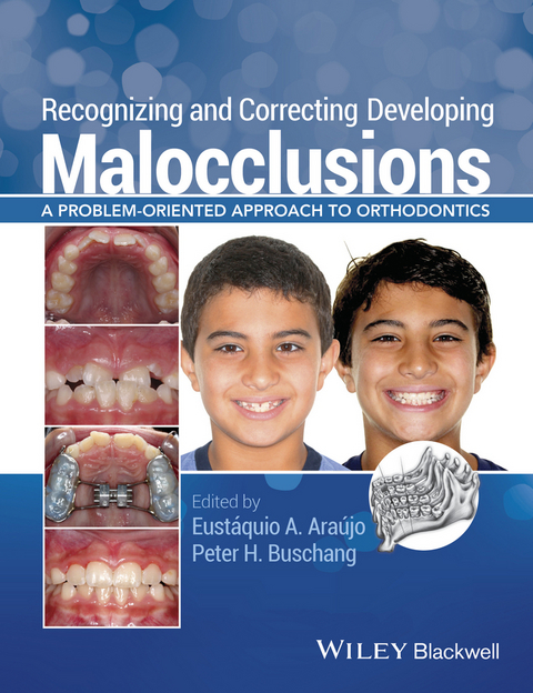 Recognizing and Correcting Developing Malocclusions - 