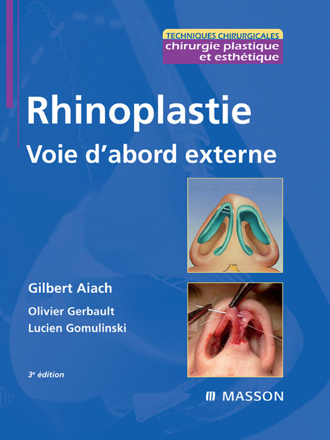 Rhinoplastie. Voie d''abord externe -  Gilbert Aiach