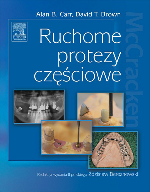 Ruchome protezy czesciowe -  Alan B. Carr,  David T. Brown