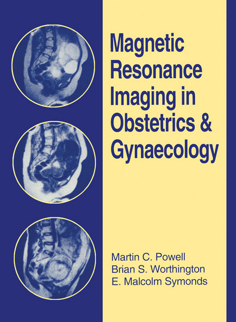 Magnetic Resonance Imaging in Obstetrics and Gynaecology -  Martin C. Powell,  E. Malcolm Symonds,  Brian S. Worthington