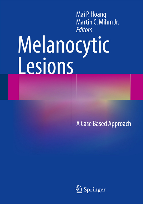 Melanocytic Lesions - 