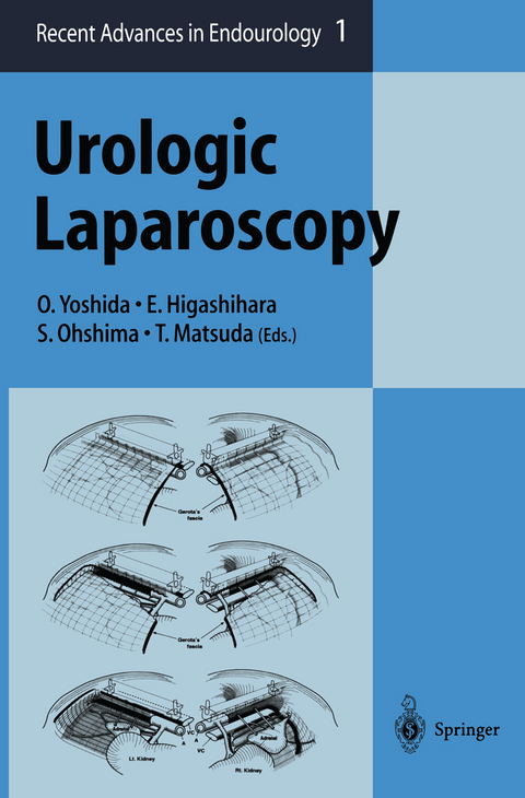 Urologic Laparoscopy - 