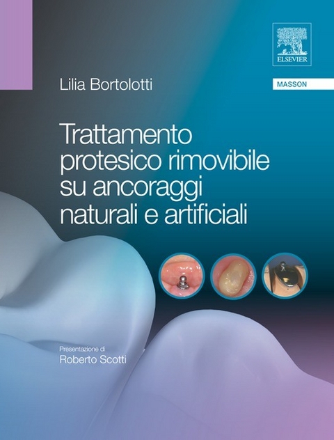 Trattamento protesico rimovibile su ancoraggi naturali e artificiali -  L. Bortolotti