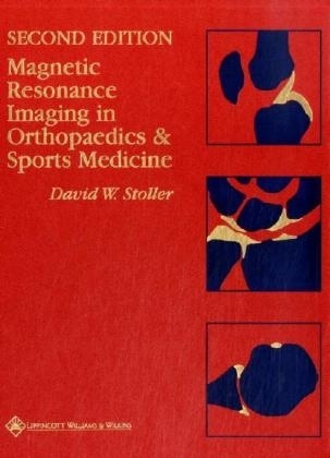 Magnetic Resonance Imaging in Orthopaedics and Sports Medicine - D. W. Stoller