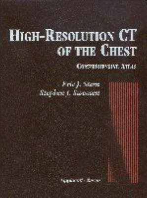 High Resolution CT of the Chest - Eric Stern, Stephen J. Swenson